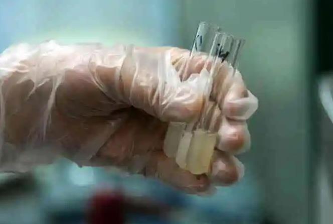 成都西囡醫院試管費用試管嬰兒有哪些花銷?