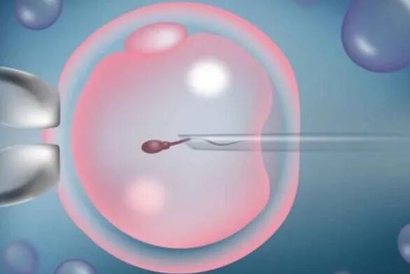 福州助孕中介機構(gòu) 福州總院第三代試管嬰兒費用要多少?三代試管費用貴嗎? ‘孕囊59x55怎么看是男孩女孩’