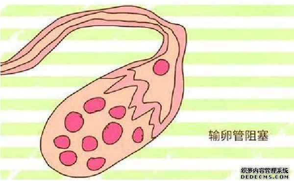 2022福州代生政策 福州總院三代試管流程及費用標(biāo)準(zhǔn)參考 ‘孕囊31*32*36是男還是女’