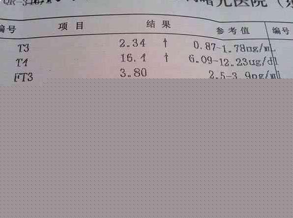 昆山供卵試管 昆山試管嬰兒是怎么咨詢試管嬰兒咨詢方法 ‘生男的孕囊大小’