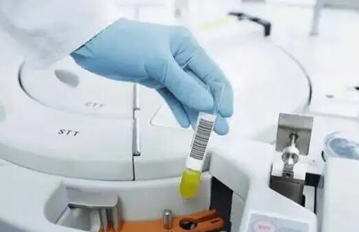 西安試管價格表 西安試管嬰兒較好的醫生參考 ‘b超如何測男女’