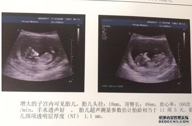 輸卵管堵塞是怎么引起的?幫你找出了6大誘因,女性值得深思!-合肥什么醫(yī)院做試管嬰兒技術(shù)好