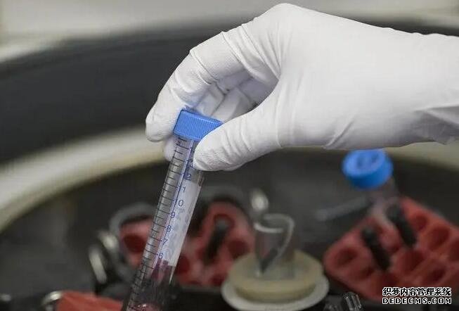 輸精管道堵塞要做哪些檢查,輸精管堵塞的原因有哪些