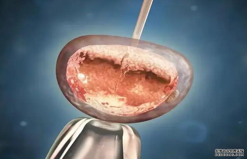 巧克力含有熱量較高,產后寶媽一定要少吃