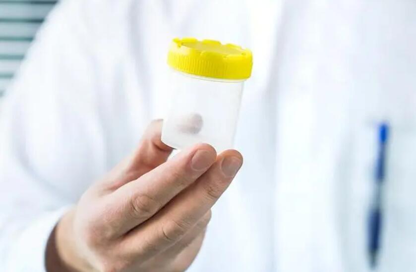 長沙 供卵試管 長沙人工授精醫(yī)院推薦: ‘孕囊32*17*26mm男孩女孩’