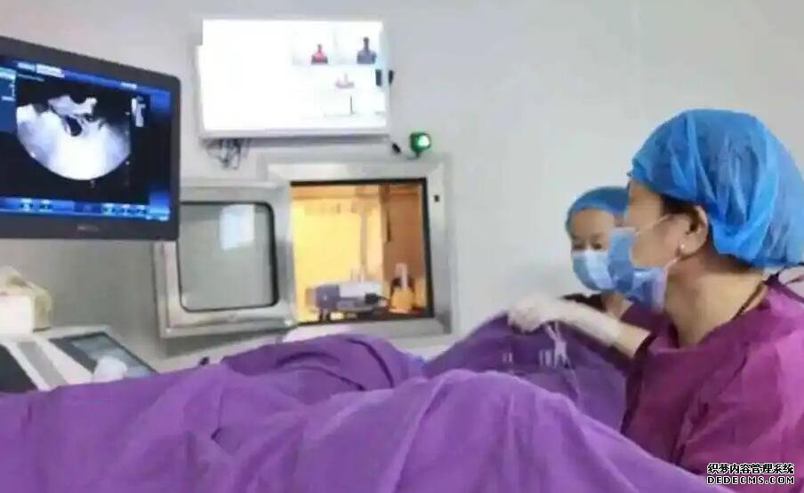 去海口捐卵 一、海口試管嬰兒成功率 ‘唐篩看男女網站’