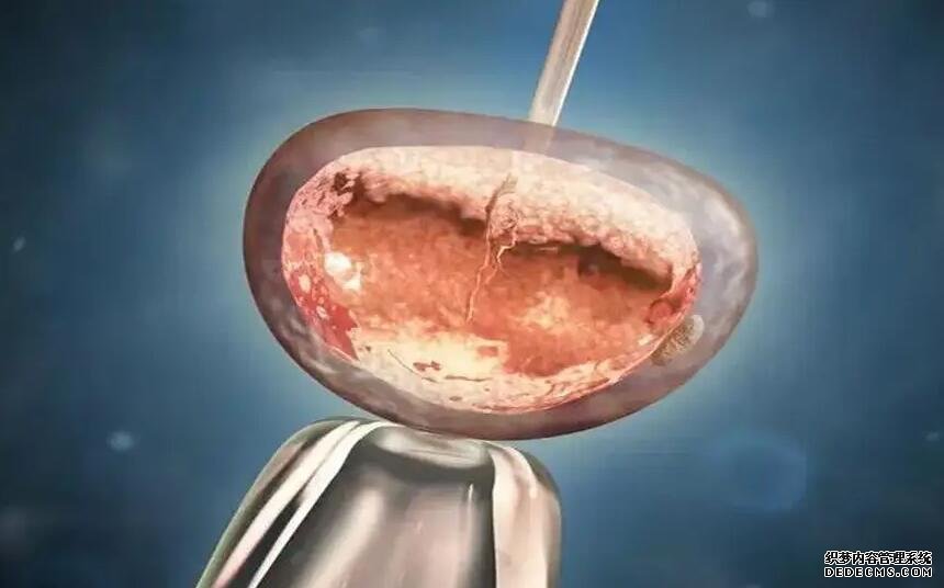 廣州代孕群 2022年在廣州做試管的費用具體是多少？ ‘四維男女暗示寫在哪’