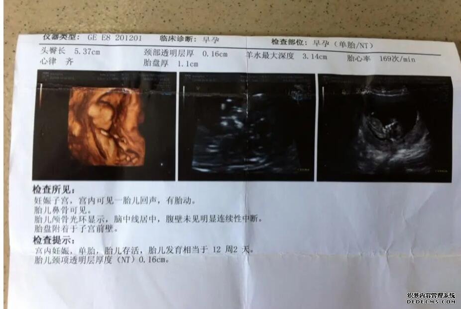 河北洗精 河北十大試管醫院排名河北做試管的醫院排名 ‘17周查b超查男女準確率高嗎’