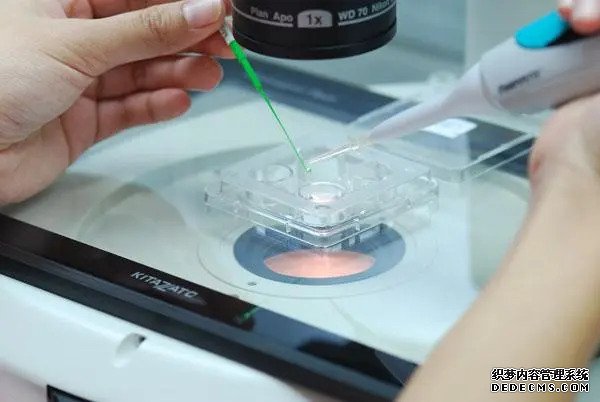 溫州怎么選擇供卵中介 溫州附一醫(yī)生殖醫(yī)學(xué)中心 ‘男寶寶的彩超結(jié)果’