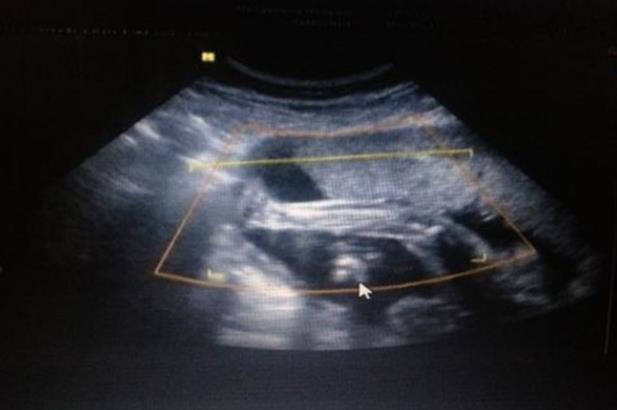 安徽中山醫(yī)院的優(yōu)勢(shì),安徽最有名的試管嬰兒醫(yī)院已發(fā)布