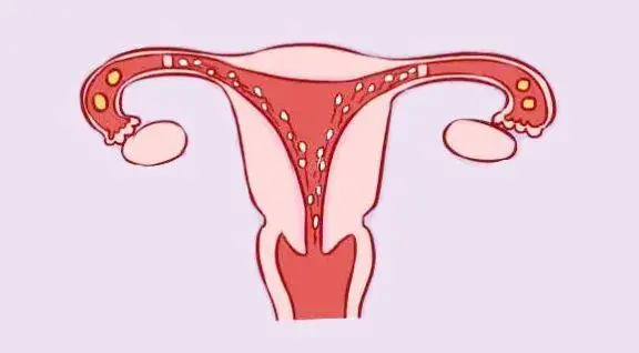 北京試管進醫(yī)保 北京試管嬰兒合適哪些人群? ‘彩超怎樣看男孩還是女孩圖片’