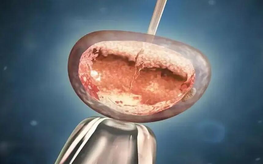 昆明愛維試管 昆明愛維艾夫試管醫院好不好?一次試管成功率有多少? ‘b超查男女會不會把臍帶看成是男孩’