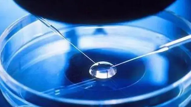 北京試管排名 北京哪個醫院能做供卵試管嬰兒? ‘孕囊26*27*10像男孩女孩’