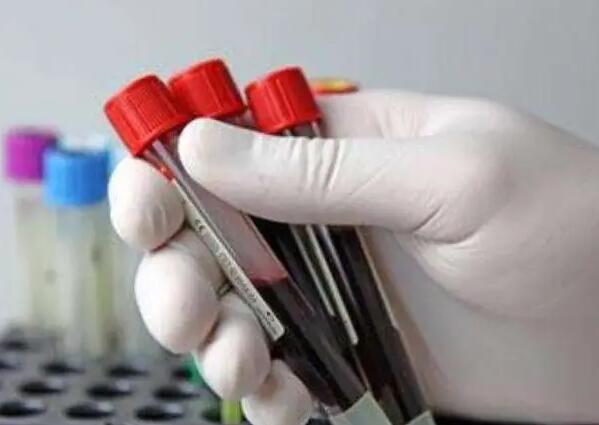 福州代生的費用 最新福州哪家試管醫院成功率最高 ‘唐篩可以預測男孩女孩嗎’