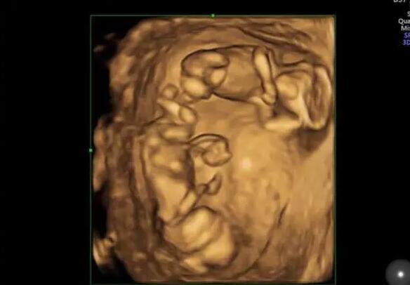 西北婦幼做試管嬰兒成功率高不高?一次試管多少錢?