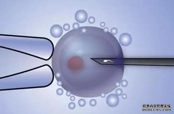 南昌借卵自懷費用 南昌可以做第三代試管嬰兒?試管成功率怎么樣? ‘胎囊三個數據呈遞減是男還是女’