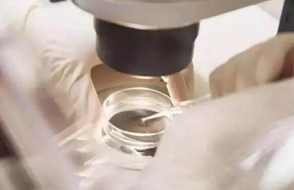 重慶試管醫院排名榜重慶試管嬰兒 重慶婦幼做試管嬰兒的費用多少? ‘24周b超可以通過長相判斷男女’