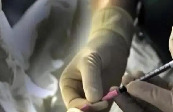 濰坊960試管醫院 濰坊哪個醫院做試管嬰兒好？是否能一次成功？ ‘四維胎兒趴著能看男女嗎’