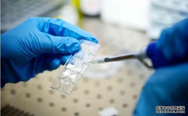 盤點女人每天泡腳的6個好處,早知早受益