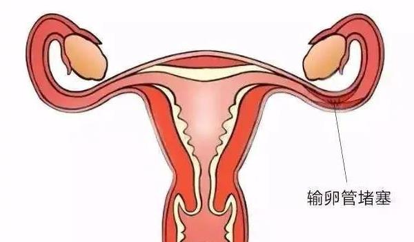 武漢長江試管 2023武漢供卵試管費用多少? ‘四維兩條白線加凹槽女孩嗎’