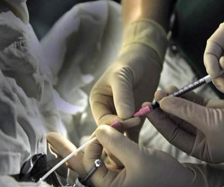 山東試管權威 山東正規(guī)生殖醫(yī)院做供精人工授精要排隊嗎? ‘5-6周b超如何看男孩女孩’