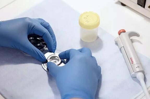 岳陽市婦幼試管費(fèi)用大概多少 岳陽一醫(yī)院試管嬰兒實(shí)驗(yàn)室?guī)闵顚哟瘟私庠嚬軏雰?‘nt值1.0mm男孩還是女孩’