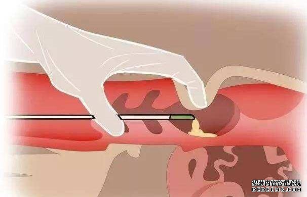 杭州地下代孕點 杭州邵逸夫醫院就診指南分享 ‘9個最準懷女孩征兆有哪些’