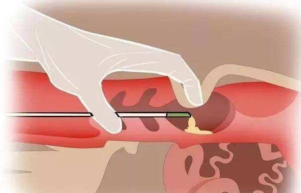長沙湘雅醫院做試管嬰兒多少錢？每一代花銷都不同