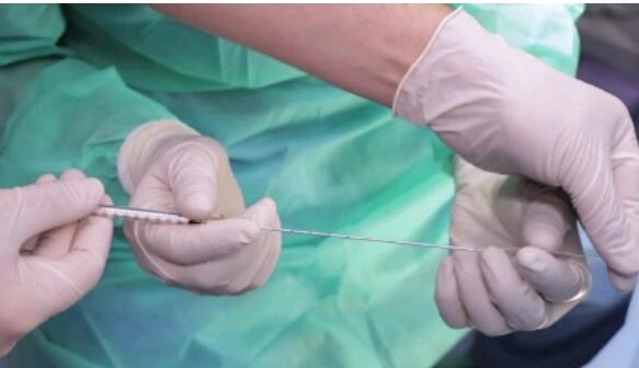 湖北試管醫院哪家好 湖北能做供卵試管嬰兒的醫院有幾家 ‘彩超下的男孩’