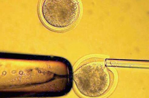 廣州試管最好私立醫院做試管多少錢 患子宮腺肌癥能不能去廣州做試管嬰兒 ‘懷男孩4個月b超單數據’