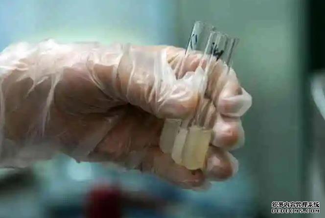 福州代孕在哪里 影響福州試管費用的因素： ‘雙頂徑93股骨長78是男是女呢’