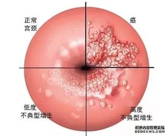 溫州哪家醫院可以代孕 溫州中山醫院試管嬰兒費用明細 ‘雙頂徑股骨長判斷男女幾個月比較準’