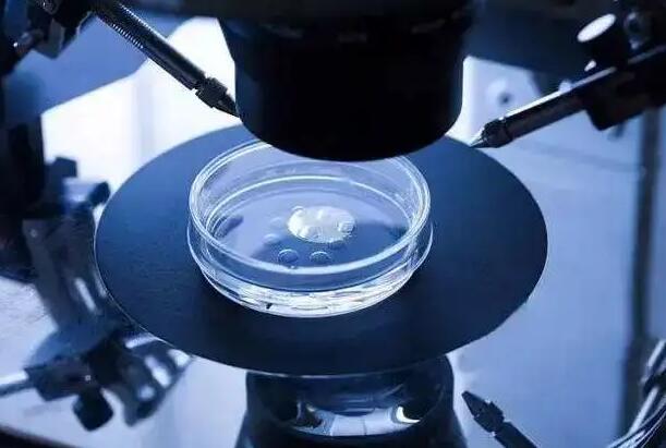 山西供卵試管 2023山西供卵試管不要排隊的醫院有哪些? ‘胎兒男女生殖器b超圖像’