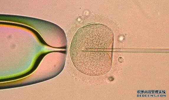 河北捐卵q群 河北生殖婦產(chǎn)醫(yī)院試管嬰兒費用明細 ‘四維b超數(shù)據(jù)怎么看男女寶寶最準(zhǔn)確的’