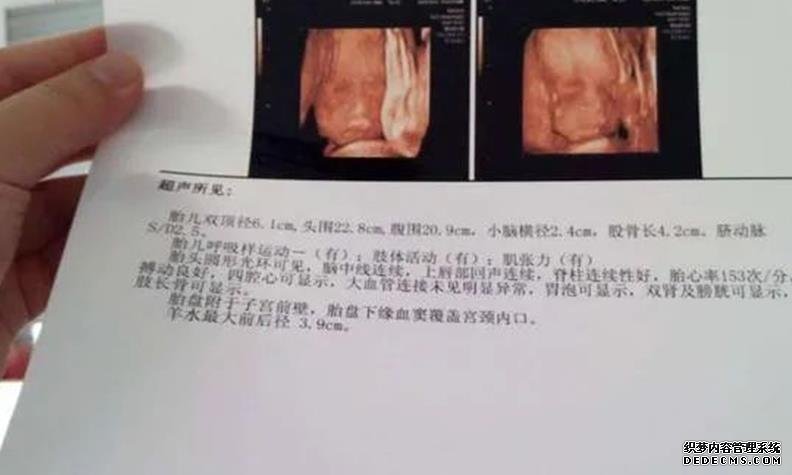 杭州代懷最新政策 杭州做試管嬰兒能不能一次成功? ‘懷男寶寶媽媽特征’