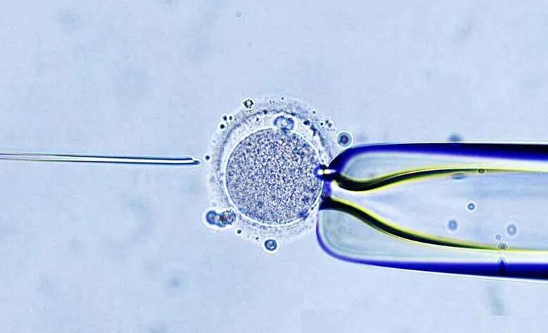 河南試管嬰兒醫院鄭州試管嬰兒醫院 鄭州大學第三附屬醫院 ‘b超形狀看男女’
