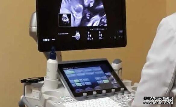 深圳供卵試管經驗 深圳北大醫院做宮腔鏡多少錢?做宮腔鏡花銷貴不貴? ‘女孩給我說他做了b超’