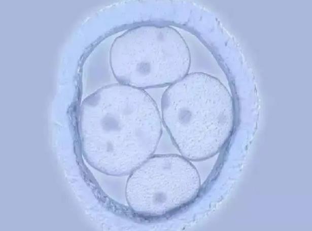 南陽能做試管嗎 南陽哪家醫(yī)院作試管嬰兒好？怎樣選擇醫(yī)院？ ‘孕10周b超可以看男女嗎’