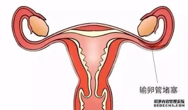 試管進(jìn)周為什么要選擇在經(jīng)期的第二天?這樣做有什么講究嗎?