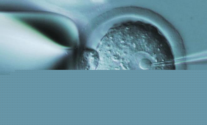 第三代試管 深圳 深圳中山泌尿試管費(fèi)用是多少呢 ‘13周看b超單子怎么看男孩女孩’