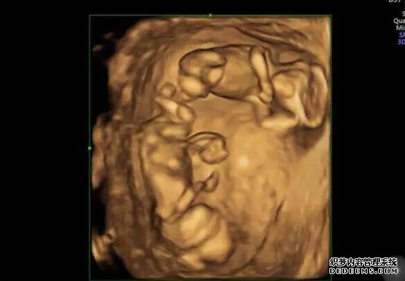 生化妊娠不會影響女性的生育能力,隔月懷孕的例子也有很多