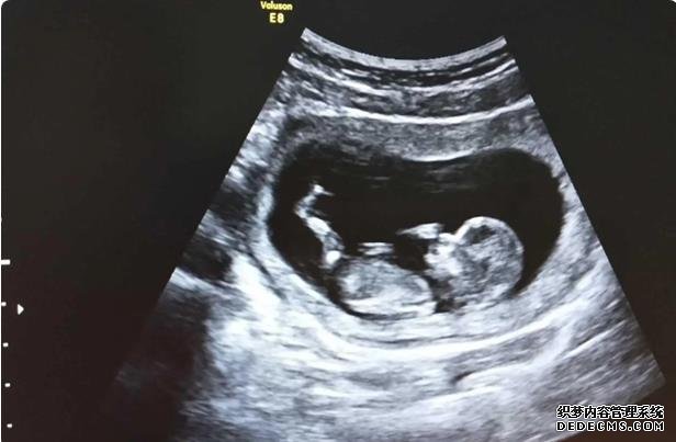 深圳失獨代孕機構 2022北京大學深圳醫院可以做第三代試管嬰兒生男孩嗎？ ‘四維彩超報告可以看出是男是女’