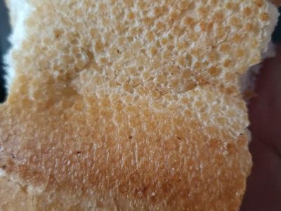 嬰兒體癬的成因與預防探討