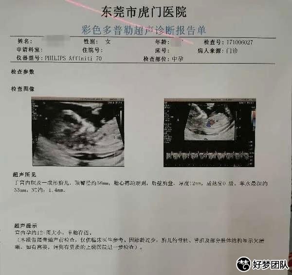 多囊月經不調難懷孕