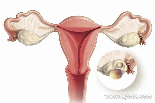 正常卵泡萎縮不會影響懷孕幾率