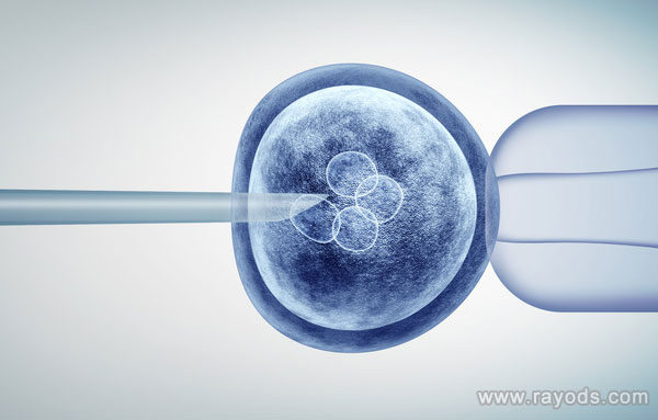 上海試管嬰兒機構該選擇哪個