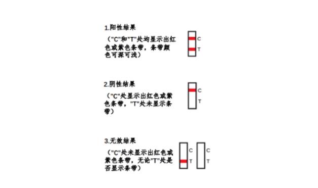 北京301醫院試管嬰兒流程 北京協和醫院供卵試管的流程都有什么? ‘女寶寶b超也有兩個蛋蛋一樣’