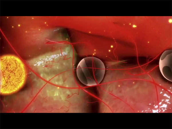 試管嬰兒培養(yǎng)全是四級(jí)胚胎怎么辦？四級(jí)胚胎養(yǎng)囊成功率講解