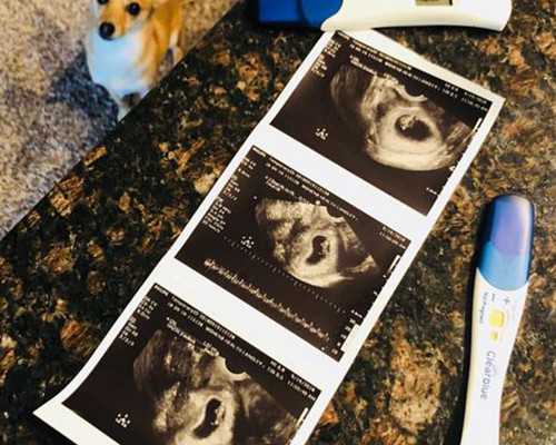 焦作做試管嬰兒，成功率到底怎么樣？