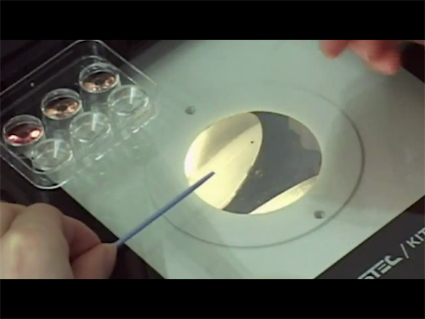 試管嬰兒篩選男女哪個(gè)幾率高？2025年做一次試管需要多少錢